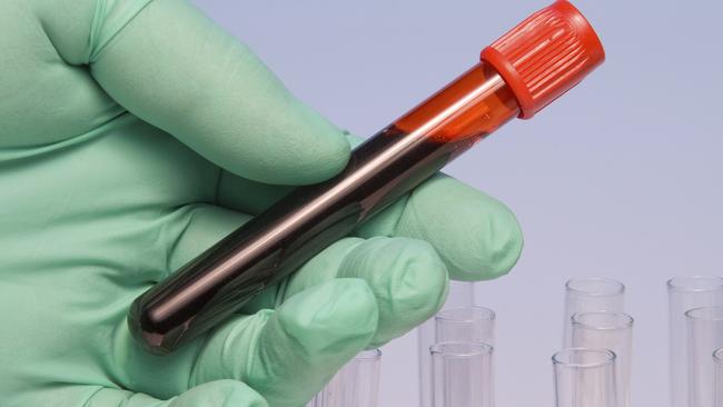 A blood test could identify which patients are at risk of colon cancer recurrence. Picture: istock