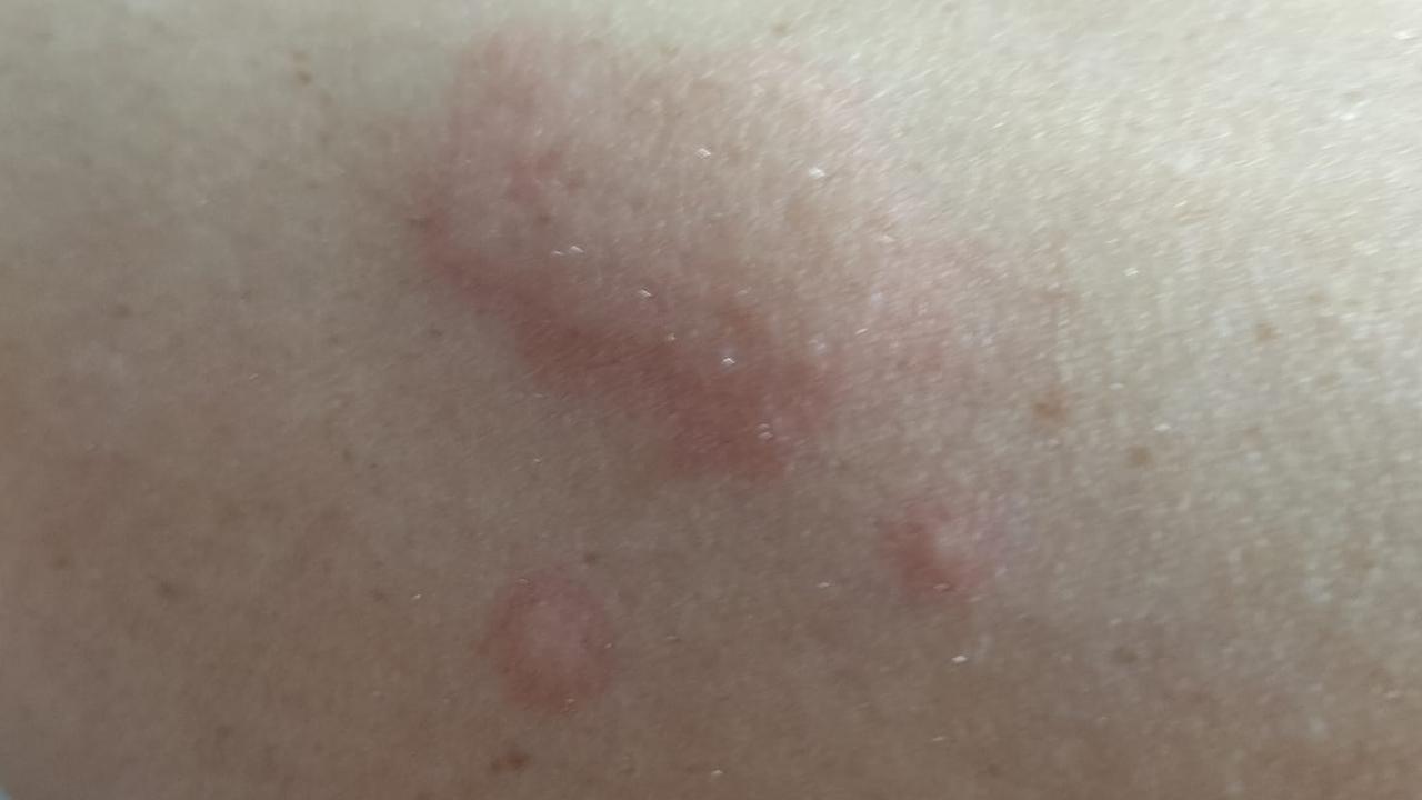 Locals say they suffer from vomiting, headaches, rashes and breathing problems. Picture: Facebook
