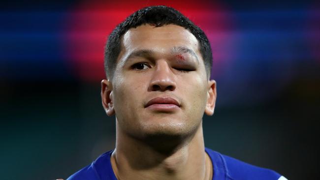 Dallin Watene-Zelezniak had a tough start to his Bulldogs career. Picture: Phil Hillyard