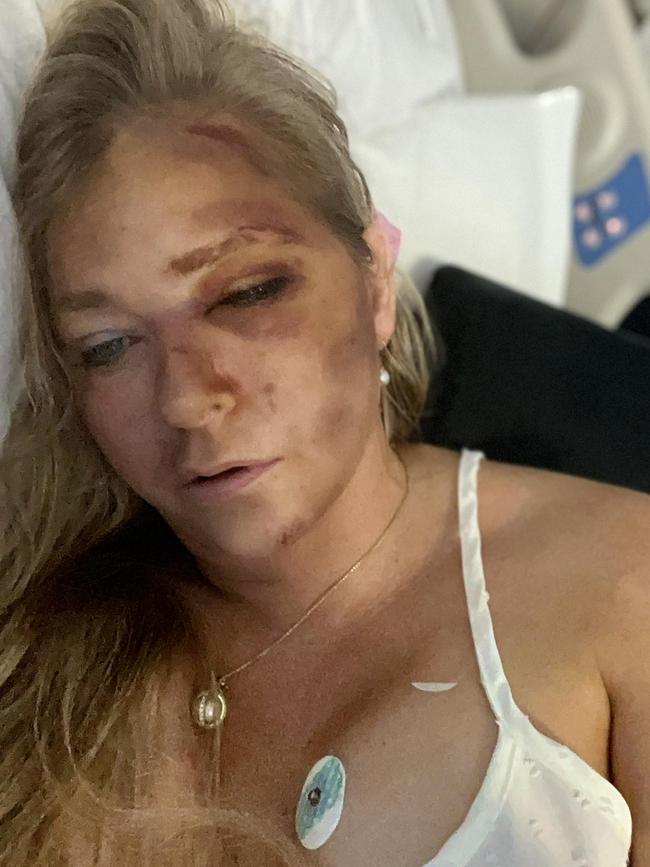 She’d recently sparked concern with an alarming post about her health. Picture: Instagram