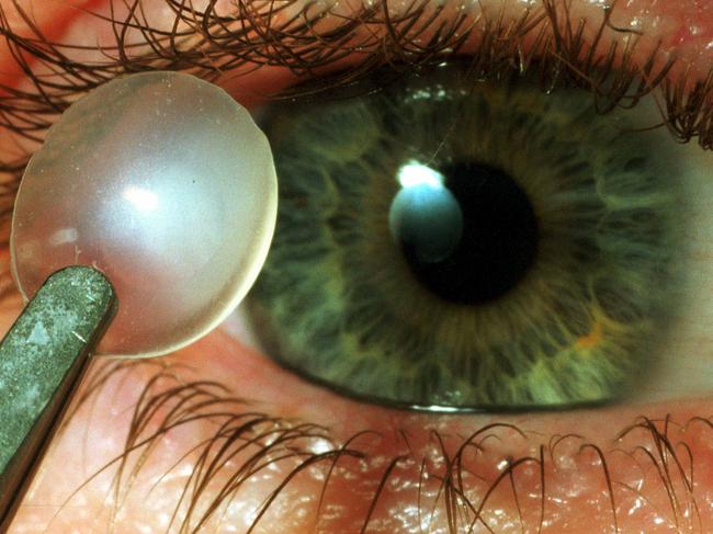 Dr Tim Hughes holding CSIRO newly devloped permanent contact lens to his eye 17 Jun 2002.