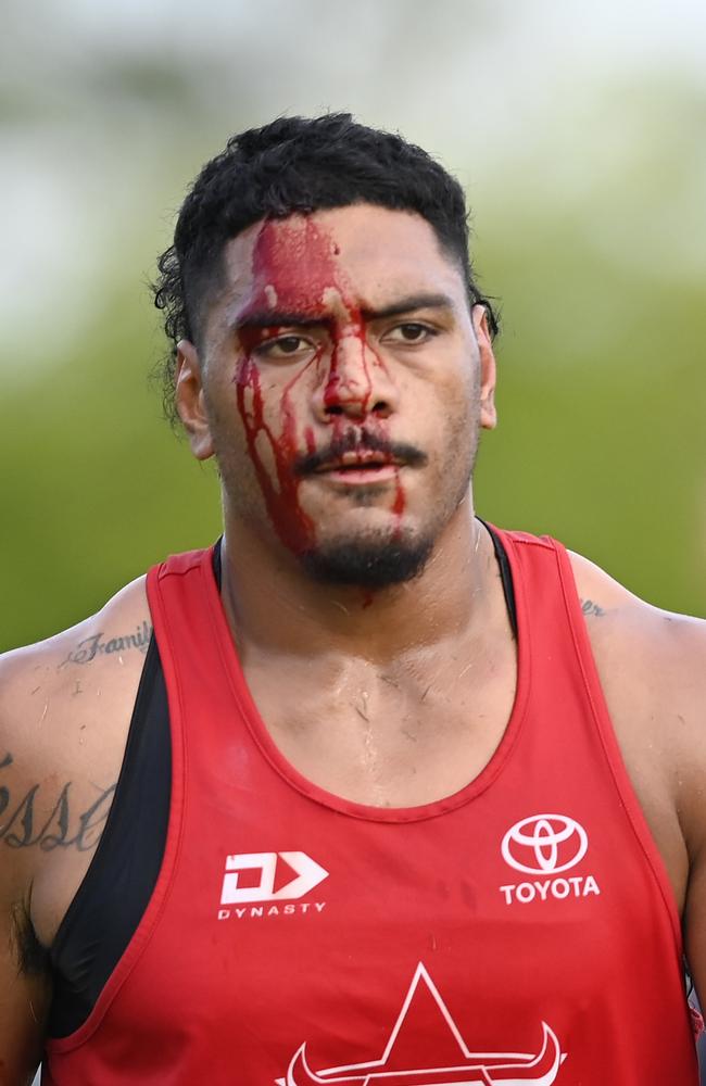 Thomas Mikaele of the Cowboys bleeds from a head gash during a North Queensland Cowboys NRL training session at Queensland Country Bank Stadium on January 14, 2025 in Townsville, Australia. (Photo by Ian Hitchcock/Getty Images)