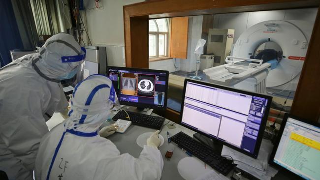 Medical staff make a CT scan for a patient infected by the COVID-19 coronavirus at Red Cross Hospital in Wuhan in China. Picture: AFP