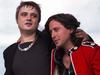 Rock star had both earlobes bitten off