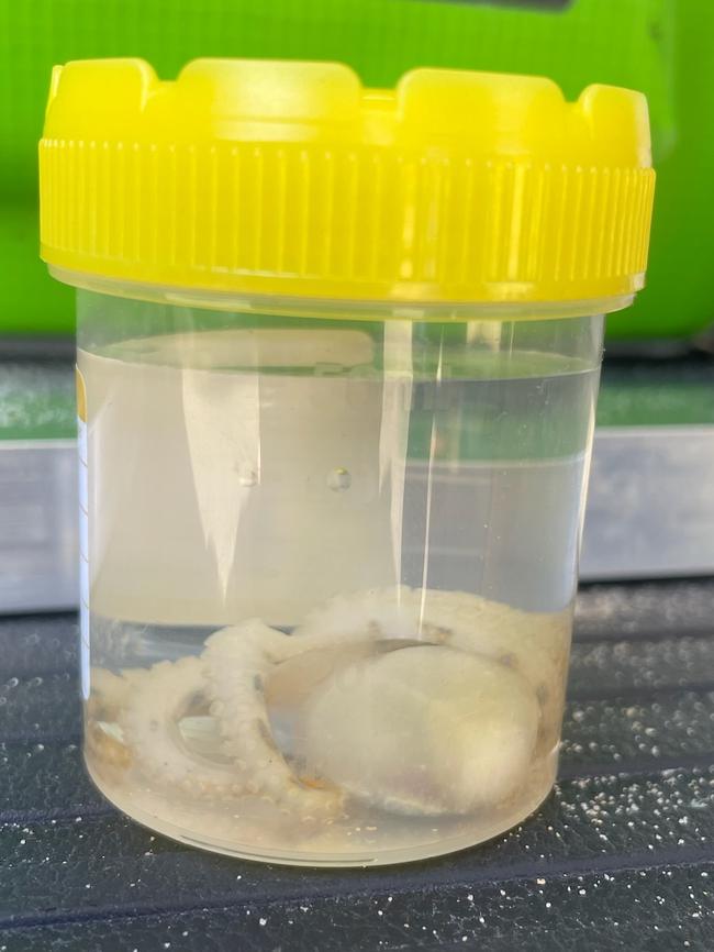 A woman in her thirties was bitten at a popular Mosman beach by a deadly blue-ringed octopus. Picture: NSW Ambulance.