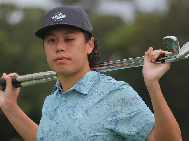 Young Australian golfer Jeff Guan talks for the first time after he was hit by a golf ball in the eye at a Pro Am event in September. Photo: David Tease/Golf NSW.