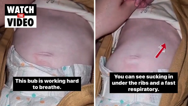 Terrifying video shows infant struggling to breath