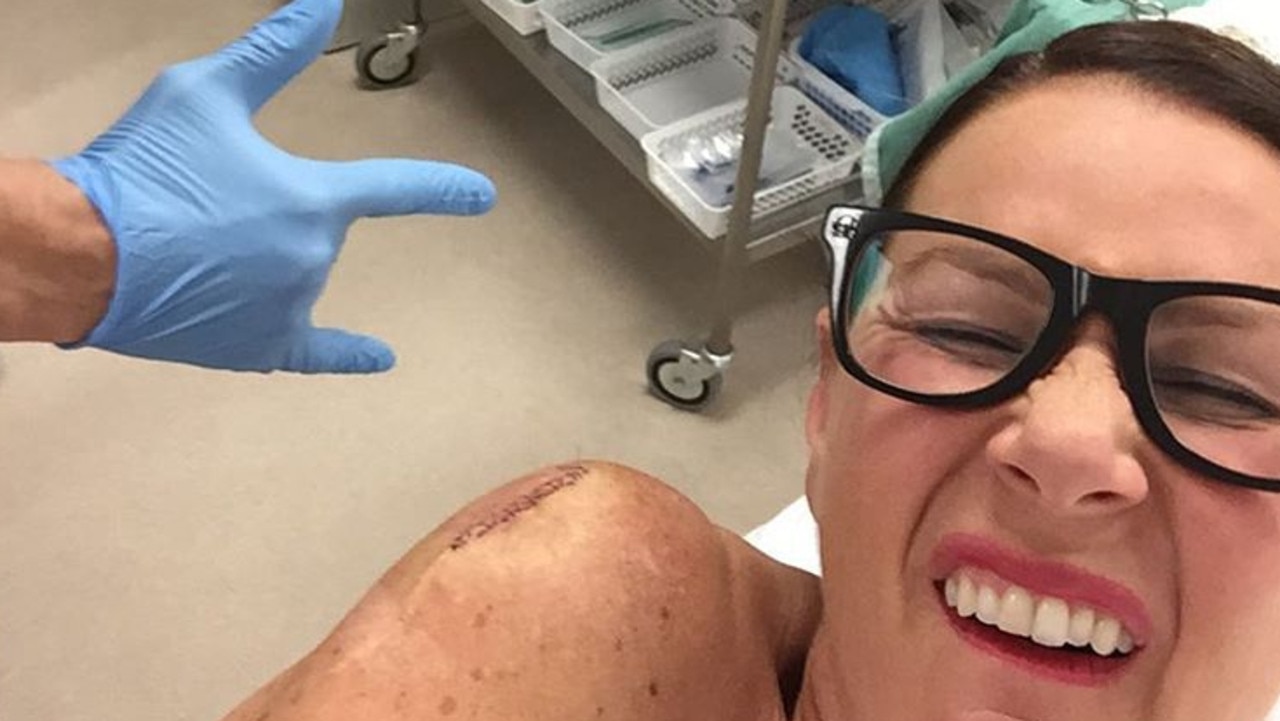 Julia Morris urged her fans to get skin checks and wear sunscreen after a painful skin cancer removal procedure.