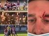 Cops vow local footy violence crackdown
