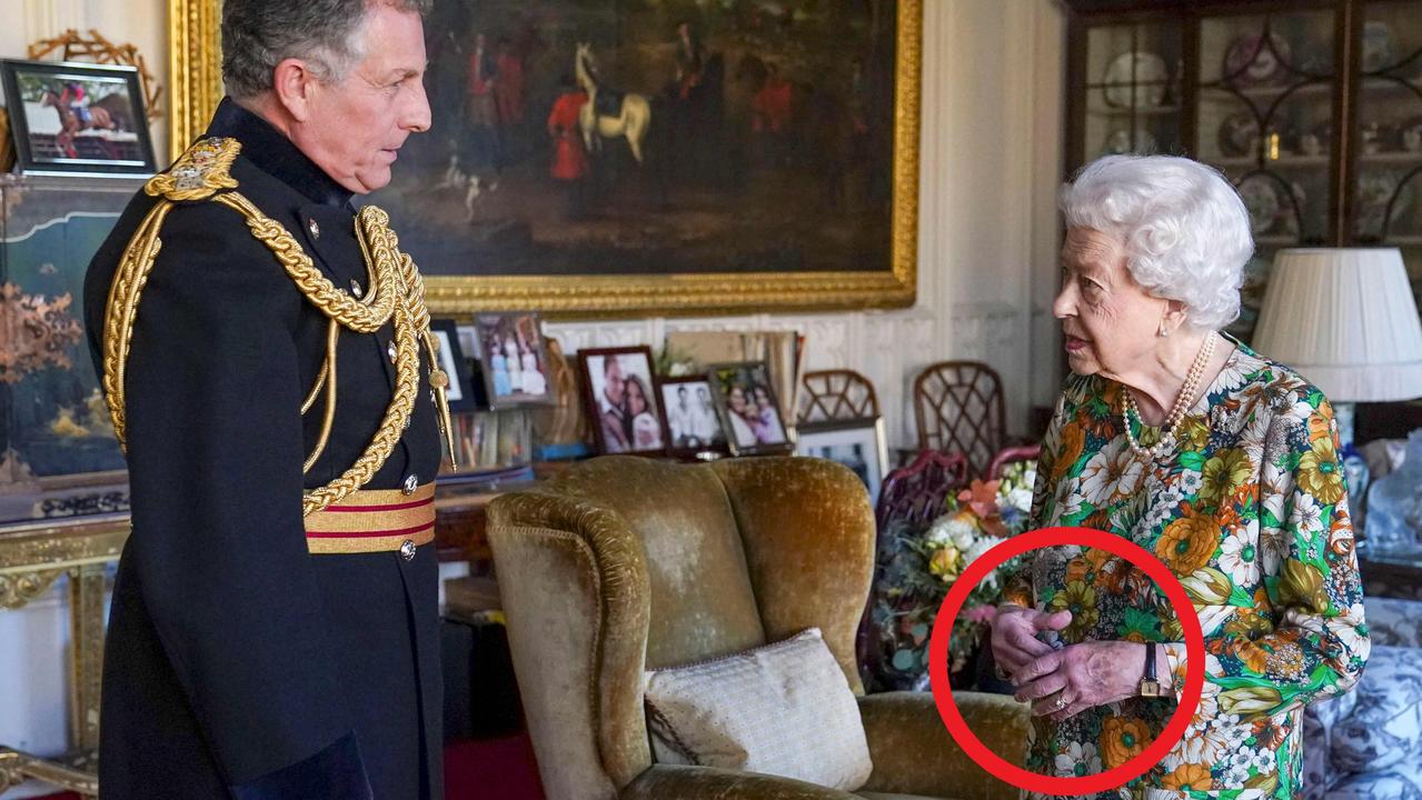 Royal watchers expressed concerns about the colour of her hands.