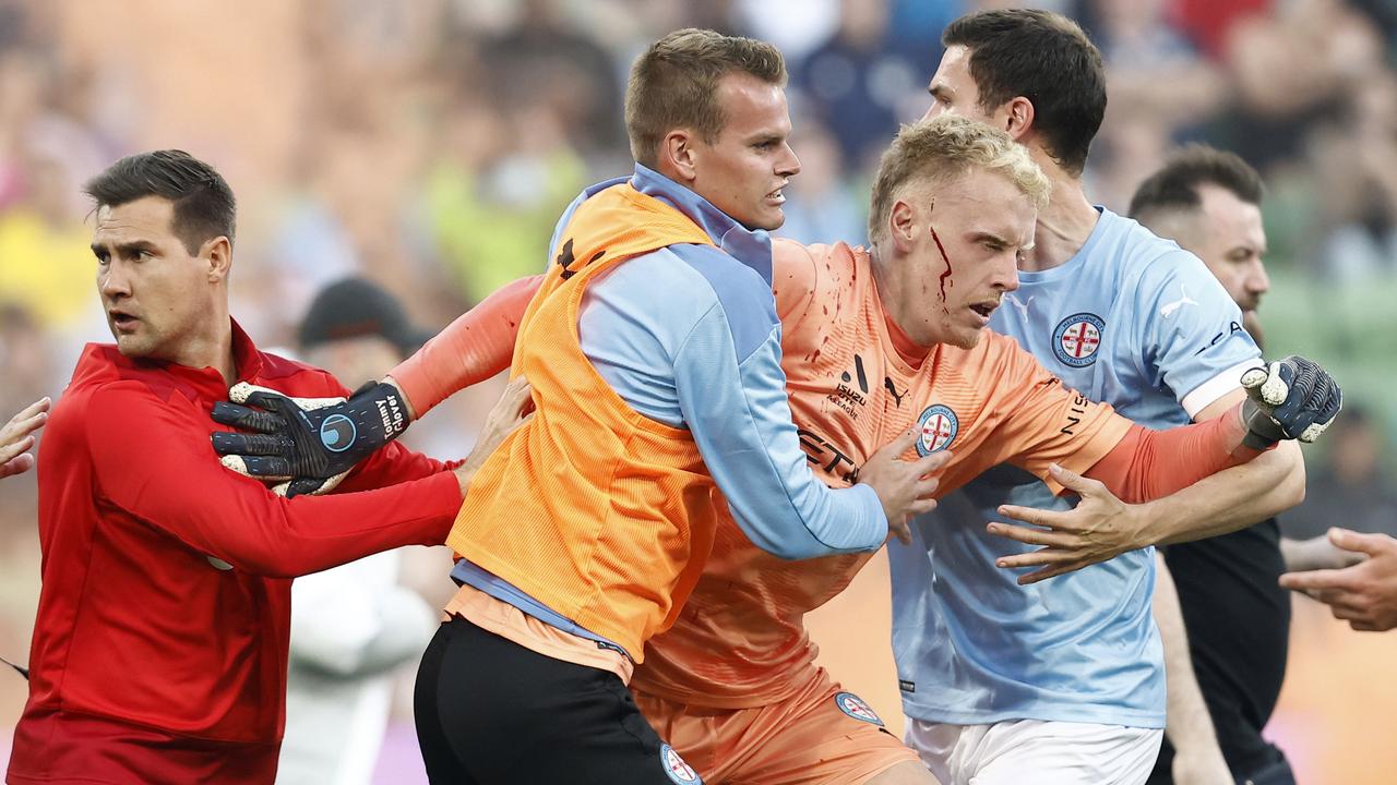 A bleeding Tom Glover of Melbourne City is escorted from the pitch (Photo by Darrian Traynor/Getty Images)
