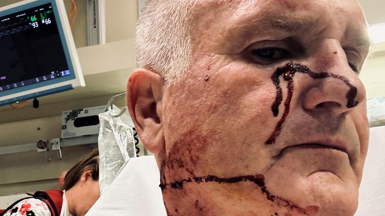 An AFP officer needed hospital treatment after being stabbed in the face and neck with a pen at Perth Airport. Picture: Australian Federal Police