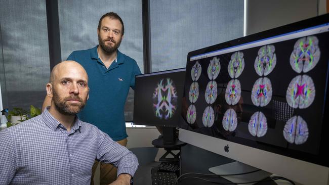 Monash researchers David Wright and Sandy Shultz have been undertaking MRI brain scans of concussed footballers. Picture: Wayne Taylor