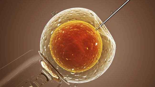 Cell injection — artificial insemination. Picture: Ssupplied