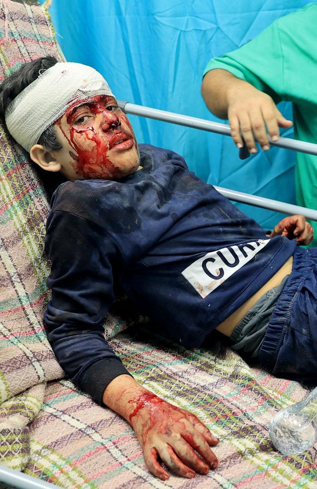 A young injured Palestinian boy lies on a gurney at the Al-Aqsa Hospital following the Israeli bombardment of in Deir el-Balah, in the central Gaza Strip. Picture: AFP