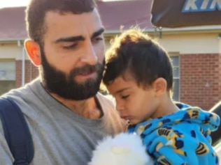 Ismael Hafiz was left bloodied and bitten after a small dog attacked him in an Adelaide playground. Photo: Advertiser