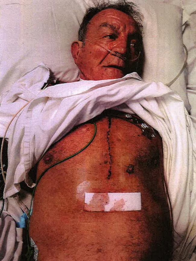 Mr Stewart underwent emergency surgery.