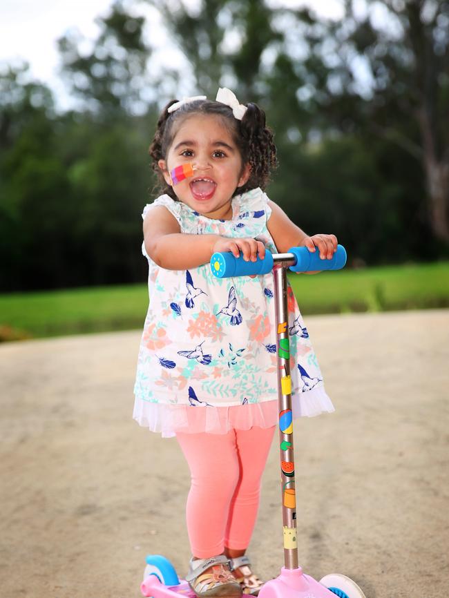 Since the liver transplant, Charlize is able to ride a scooter, run and enjoy all the other things other toddlers like to do.