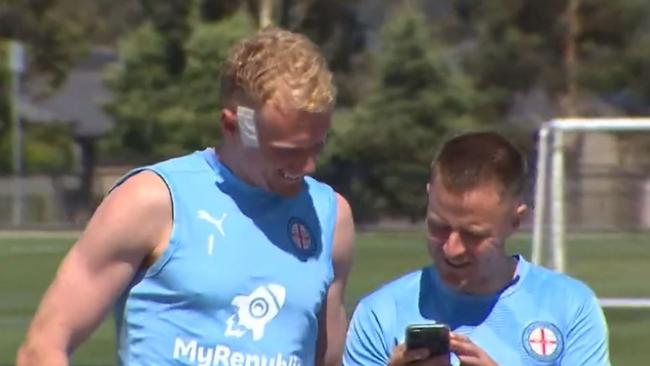 Tom Glover required five to 10 stitches and was left with a concussion. Picture: Nine News