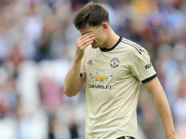 Manchester United's Harry Maguire touches his forehead as he leaves at the end of the English Premier League soccer match between West Ham and Manchester United at London stadium in London, Sunday, Sept. 22, 2019. West Ham beat Manchester United 2-0. (AP Photo/Leila Coker)