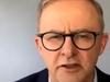 Huge days ahead for Albo who needs to reset Labor campaign