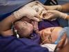 Mums help deliver their own babies in caesarean shake-up