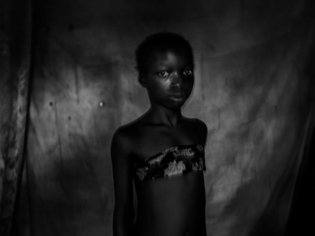 Suzanne, 11 years old. two months before that image was taken, she experienced breast ironing until her breasts were totally gone. Nov 2016, East Cameroon. Picture: Heba Khamis/World Press Photo