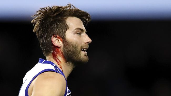 Luke McDonald was bloodied against the Bombers but his day got worse. Picture: Getty Images