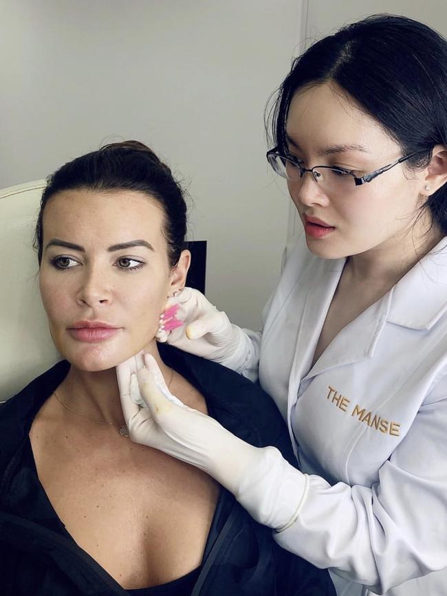 Rose receiving a skin-tightening threadlifts at The Manse.