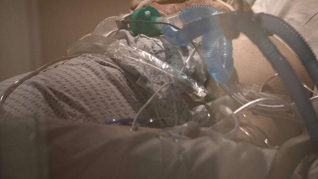 STAMFORD, CONNECTICUT - APRIL 24: (EDITORIAL USE ONLY) Breathing tubes hang next to a man with COVID-19 on a ventilator at a Stamford Hospital Intensive Care Unit on April 24, 2020 in Stamford, Connecticut. The hospital opened additional ICUs to deal the the vast number of people suffering from the coronavirus pandemic, and roughly half of the patients at the hospital are COVID-19 positive. Stamford, with it's close proximity to New York City, has the highest number of coronavirus (COVID-19) patients in the state.   John Moore/Getty Images/AFP == FOR NEWSPAPERS, INTERNET, TELCOS & TELEVISION USE ONLY ==