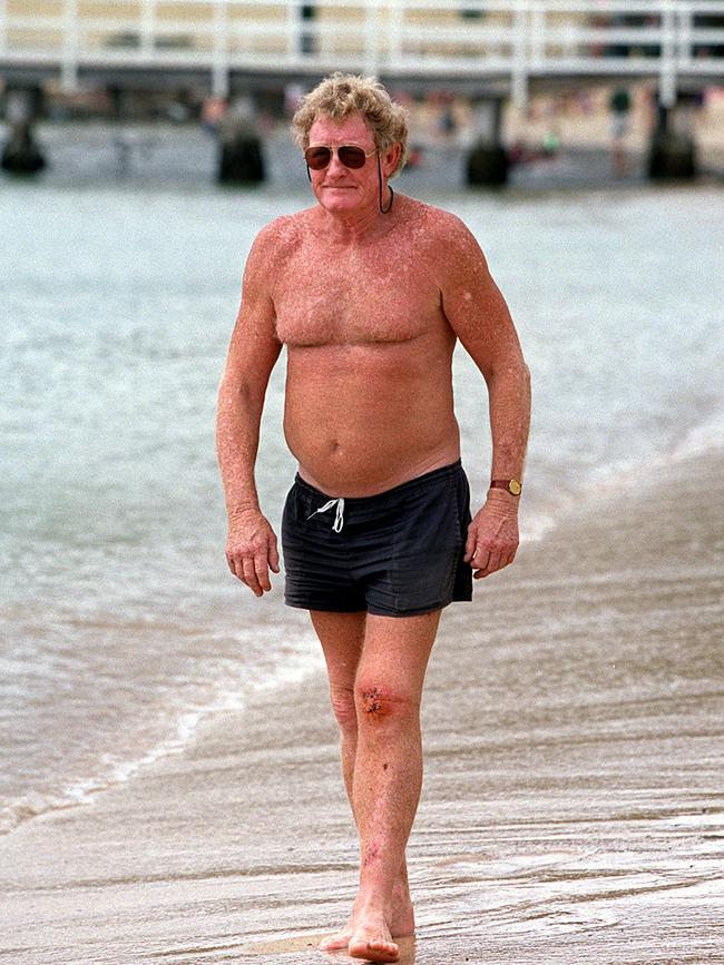 Shark attack survivor Jack Dasey on March 4, 2000, after a shark bit him on the knee off Athol Beach, Mosman, two days earlier. Picture: Brett Costello