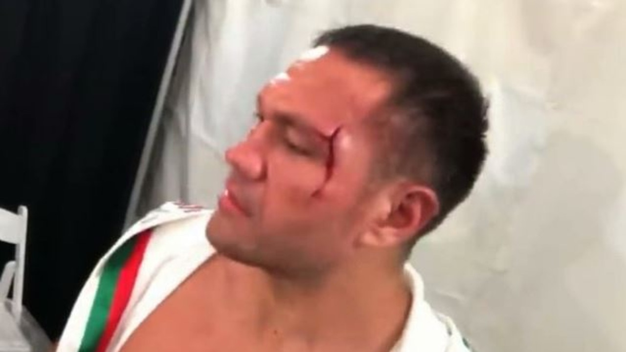 Kubrat Pulev suspended for reporter kiss.