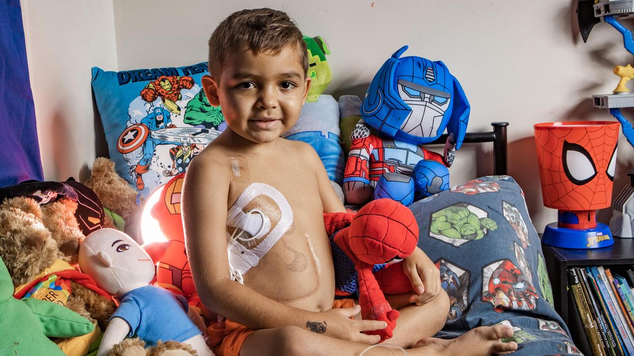 Mateoh Eggleton had the transplant on Monday. Picture: Nigel Hallett