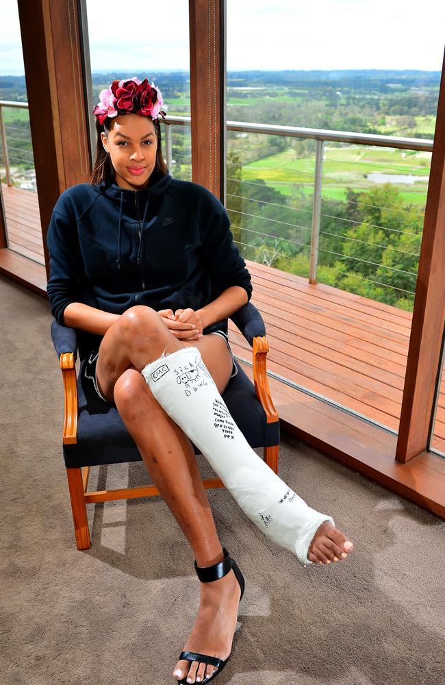 Liz Cambage recovering at home in Mt Eliza after rupturing her achilles heel last year. Picture: Derrick den Hollander