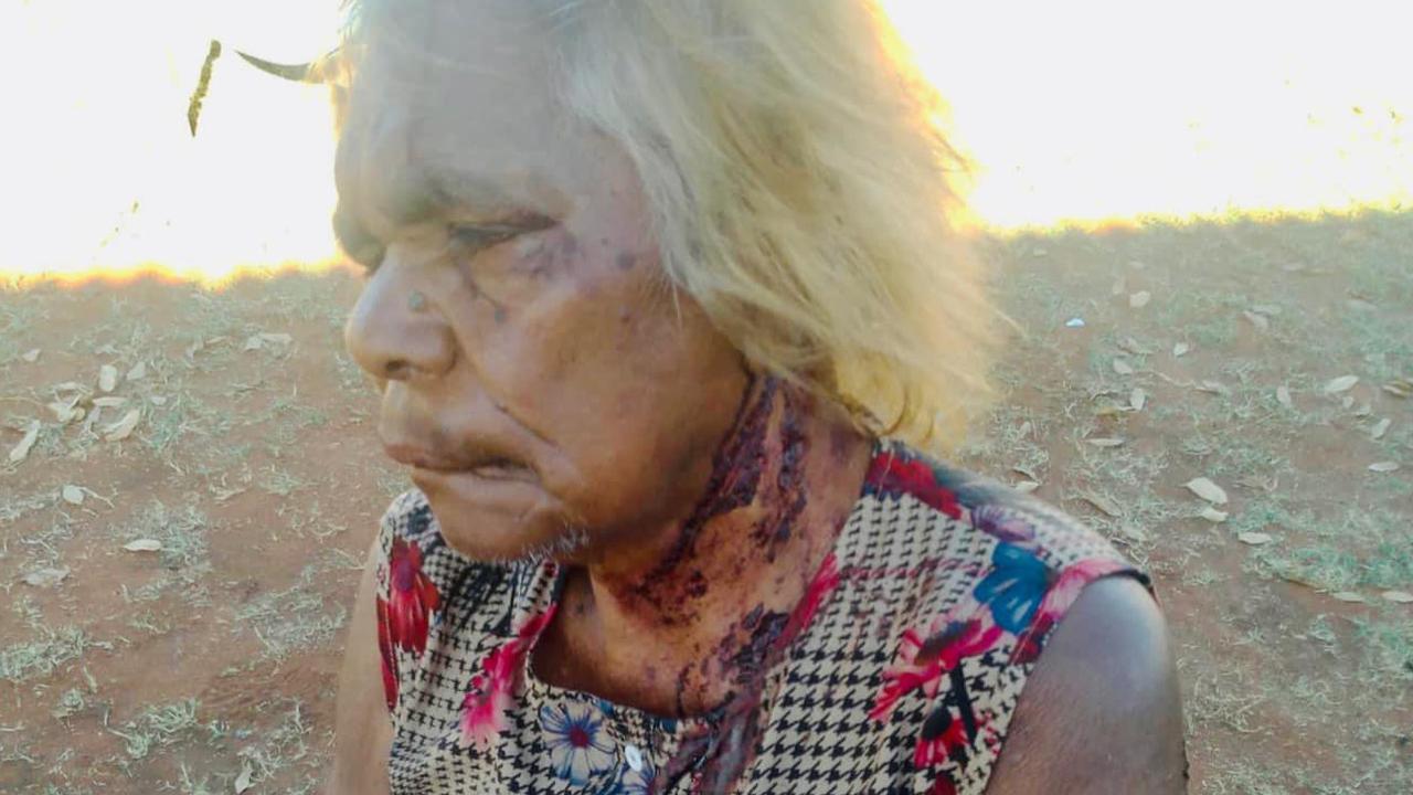 Senator Price described how her grandmother Tess Napaljarri Ross was violently beaten in Yuendumu. Picture: Facebook