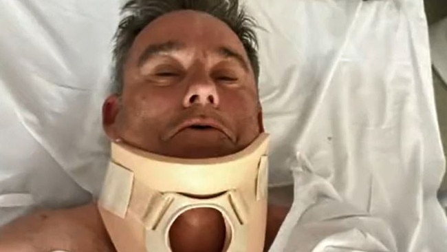 Cyclist Mark Vander says he has been left with lifelong injuries. Picture: 9 News