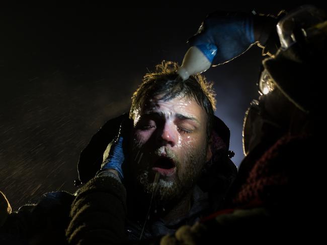 Contemporary Issues - First Prize, Stories © Amber Bracken Title: Standing Rock A man is treated with milk of magnesia after being pepper sprayed by police at the blockade on highway 1806. White people have joined the camps in large numbers, often standing in front of indigenous protestors to shield them with their bodies. Story: For nearly 10 months, members of the Standing Rock Sioux tribe and their allies camped out in opposition to the Dakota Access Pipeline crossing their territory and threatening their water supply. The estimated $3.78 billion project, backed by Energy Transfer Partners, is nearly complete, covering almost 1,172 miles