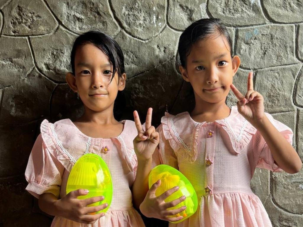 Previously conjoined twins, Nima and Dawa celebrate their 7th birthday Picture: Facebook