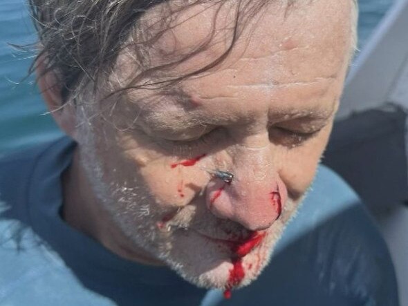 Surfer Steve Kazic was enjoying the remaining days of his holiday until a crazy fish encounter postponed his plans. Credit: Supplied.
