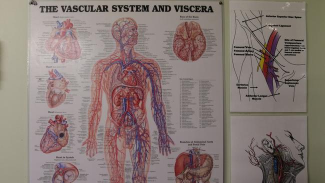 Pictured is the vascular system.