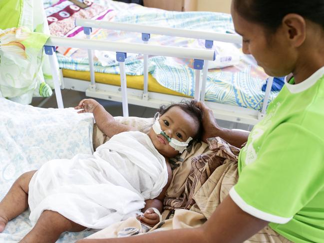 Monalisa Matulino with her child Tiresa Muliselu, 7 months at Tupua Tamasese Meaole Hospital. Picture: Infinity Images Fiji