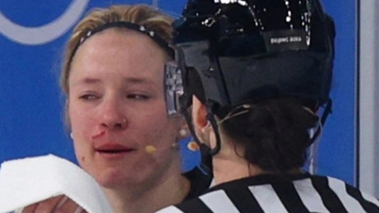 Beijing Winter Olympics 2022: Women’s hockey umpire left bleeding