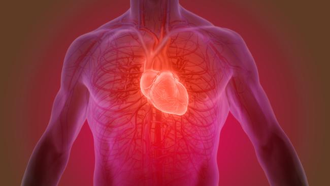 Heart valve problems affect an estimated one in four over-60s. Picture: istock