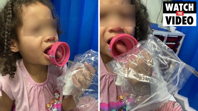 Girl Rushed To Hospital After Tongue Got Stuck In Bottle And Turned Blue Au