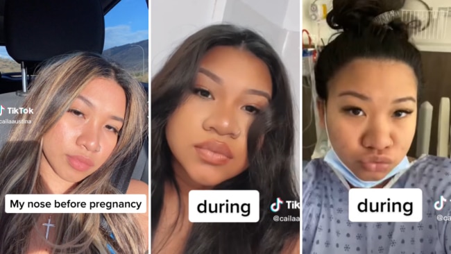 What is Pregnancy Nose?: The viral TikTok trend that shows common symptom |  Kidspot