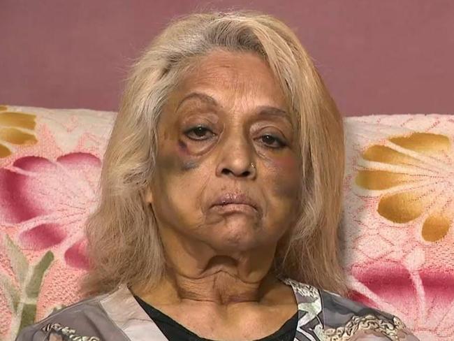 Ninette Simons, the victim of an assault and burglary in the Perth suburb of Girrawheen