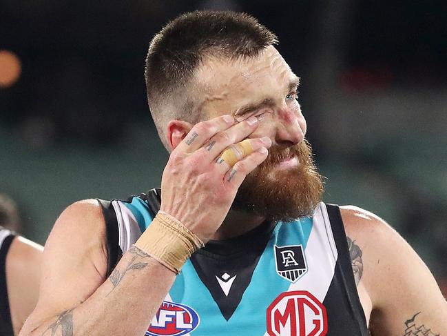 Dixon return delayed, forward pays price for Port shocker