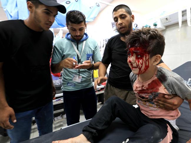 A wounded Palestinian boy waits to be treated following Israeli bombardment of Khan Yunis in the southern Gaza Strip. Picture: AFP