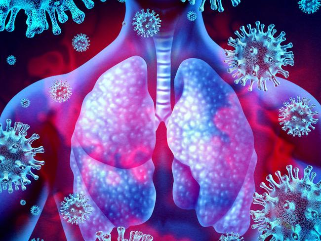 Lung virus infection and coronavirus outbreak or viral pneumonia and coronaviruses influenza as a dangerous flu strain cases as a pandemic medical health risk concept with disease cells with 3D render elements.