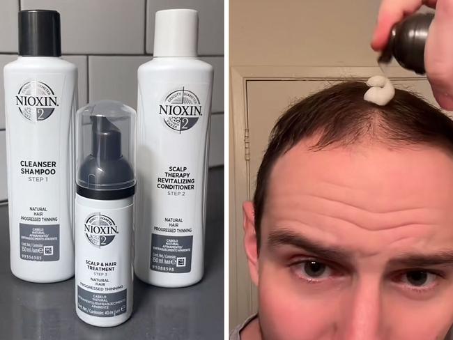 This 3-step hair thinning treatment has received hundreds of rave reviews on Amazon. Picture: TikTok/@nioxin, @lifeaszeph